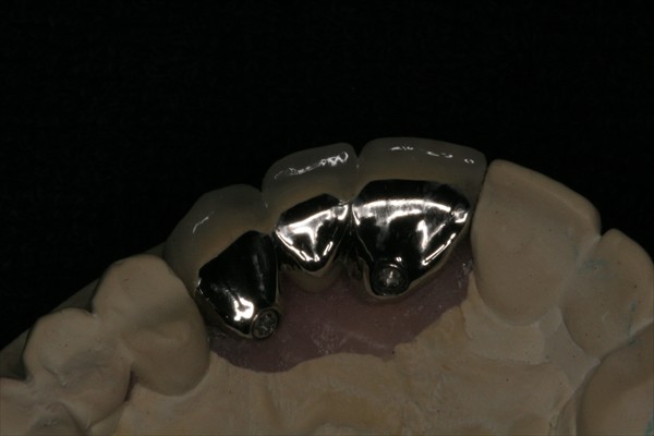 implant-v9